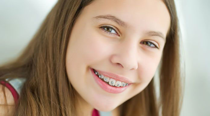 Dziecko z aparatem ortodontycznym