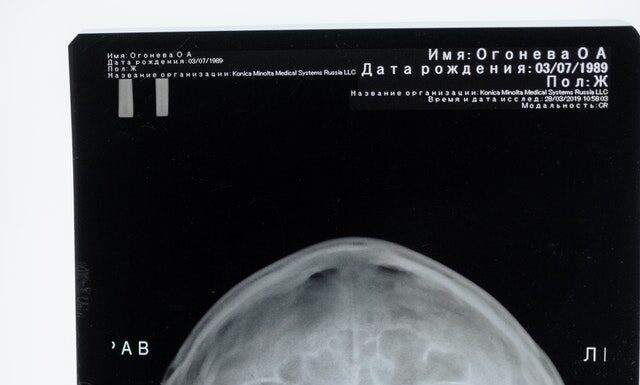 Wykonywanie zdjęć rentgenowskich w gabinecie stomatologicznym